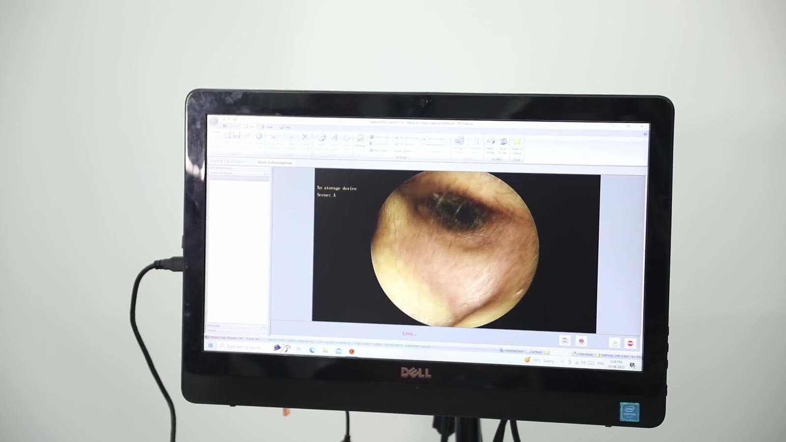 Ear endoscopy image